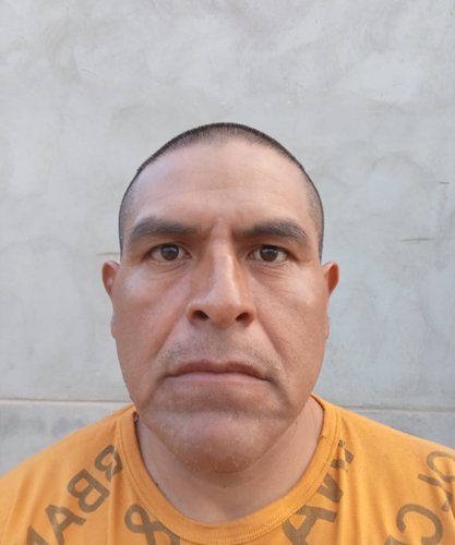 NOE